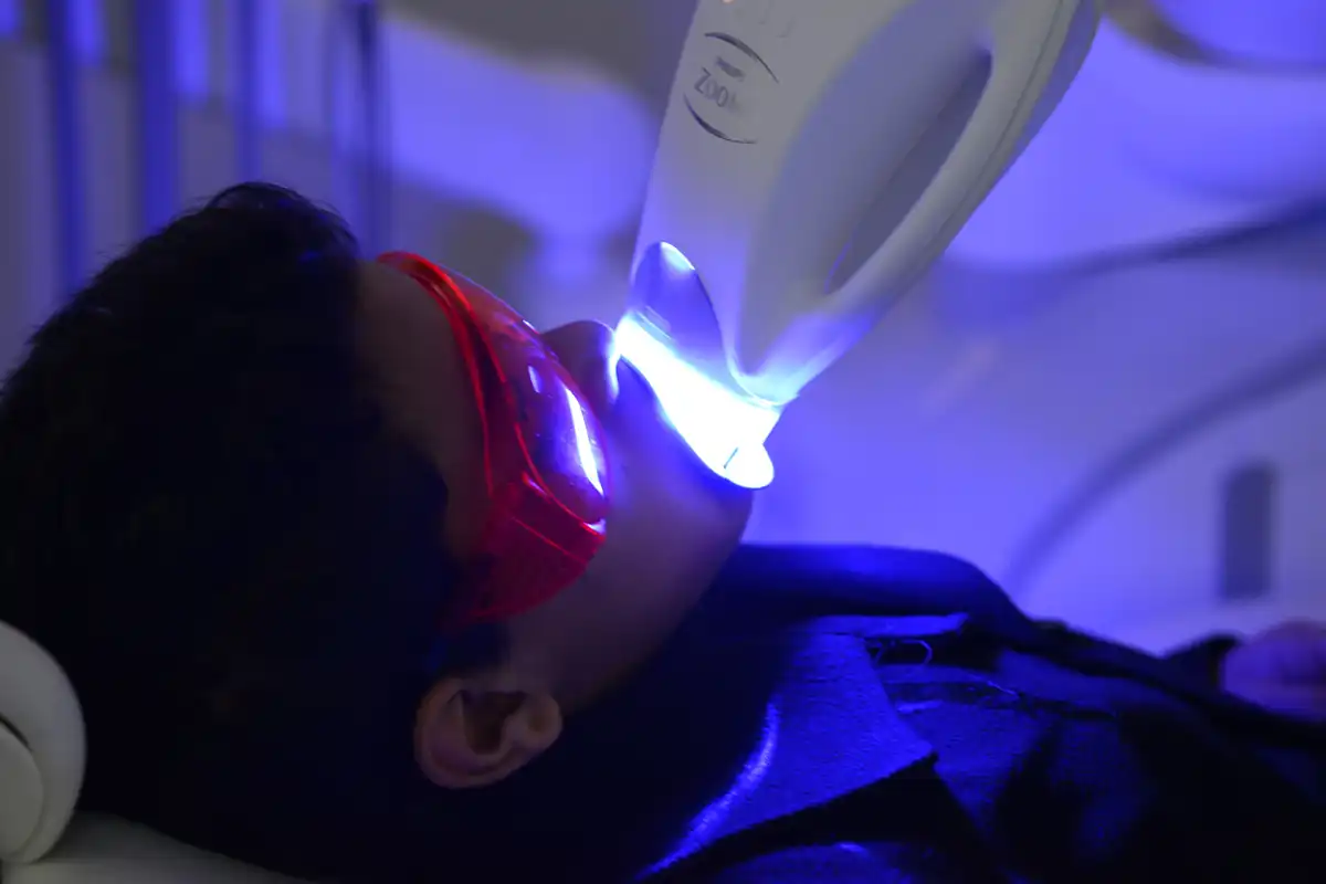 Zygomatisches Implantat Tunesien — Kieferchirurg